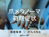 「爪にできるがん・メラノーマの初期症状」はご存知ですか？特徴についても解説！