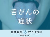 「舌がんの症状」はご存知ですか？初期症状・末期症状も解説！【医師監修】