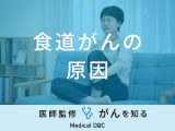 「食道がんの原因」はご存知ですか？発症しやすい人の特徴・症状も医師が解説！