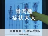 「大人の骨髄腫の症状」はご存知ですか？骨髄腫ができやすい部位も解説！【医師監修】
