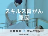 「スキルス胃がんの原因」はご存知ですか？症状や検査法も解説！【医師監修】