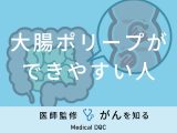「大腸ポリープができやすい人」の特徴や食生活はご存知ですか？医師が解説！