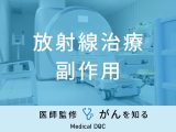 「放射線治療の副作用となる症状」はご存知ですか？予防する方法も医師が解説！