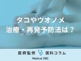【医師解説】繰り返す足のタコ、ウオノメは病院で治療できる!? 再発予防法も聞く