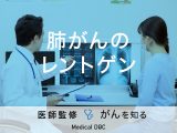 「レントゲン検査で肺がんを疑う形状」はご存知ですか？治療法も解説！【医師監修】