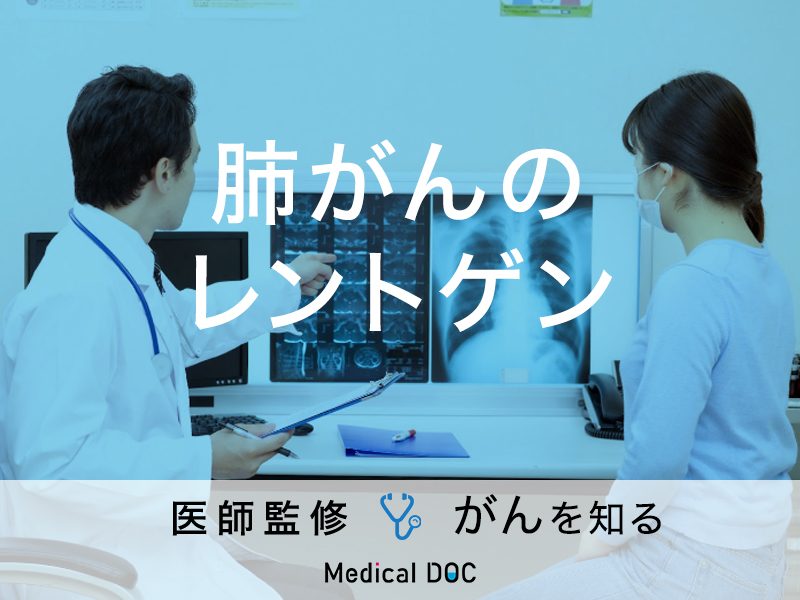 鼻腔スワブ検査は肺がんに対してどの程度効果がありますか?