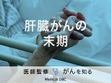 「肝臓がんの末期症状」はご存知ですか？余命についても解説！【医師監修】
