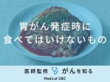 「胃がん発症時に食べてはいけないもの」はご存知ですか？予防法も医師が解説！