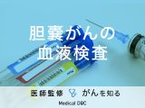 「胆嚢がん」を発症すると「血液検査」にどんな異常が現れる？【医師監修】
