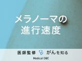 「メラノーマの進行速度」はご存知ですか？検査方法についても解説！医師が監修！