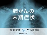 「肺がんの末期症状」はご存知ですか？初期症状や余命も解説！【医師監修】