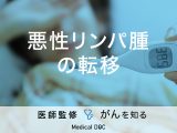 「悪性リンパ腫が転移」しやすい部位はご存知ですか？検査方法も解説！