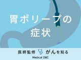 「胃ポリープができると現れる症状」はご存知ですか？予防法も医師が解説！