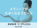 「メラノーマが大きくなるスピード」はご存知ですか？ほくろとの見分け方も解説！