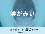「喉が赤い」ときにやってはいけないことはご存知ですか？医師が徹底解説！