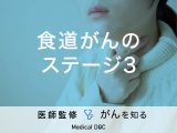 「食道がんステージ3」の症状・治療法はご存知ですか？医師が監修！