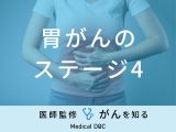 「胃がん・ステージ4」の症状・余命はご存知ですか？医師が徹底解説！