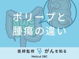 「ポリープと腫瘍の違い」はご存知ですか？がん化の可能性があるポリープも解説！