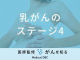 「乳がん・ステージ4」の症状・余命はご存知ですか？医師が徹底解説！