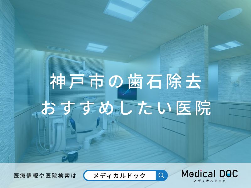 神戸市の歯石除去 おすすめしたい医院