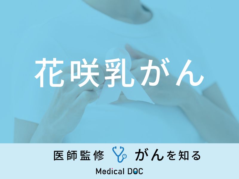 医師は乳がんをどのように診断するか