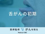 「舌がんの初期症状」はご存知ですか？受診の目安やなりやすい人の特徴も解説！