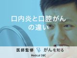 「口内炎と口腔がんの違い」はご存知ですか？見分け方のポイントも解説！