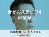 「舌がんステージ4の余命」はご存知ですか？治療法や各ステージの特徴も解説！