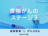 「直腸がんのステージ3」の症状・治療法はご存知ですか？医師が監修！