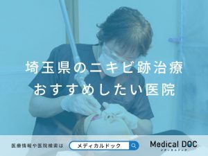 埼玉県のニキビ跡治療 おすすめしたい医院