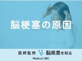 「脳梗塞の原因」はご存知ですか？初期症状・なりやすい人の特徴も医師が解説！