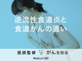 「逆流性食道炎と食道がんの違い」はご存知ですか？見分け方や症状も解説！