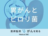「胃がんとピロリ菌」の関係性はご存知ですか？ピロリ菌以外の原因や症状も解説！