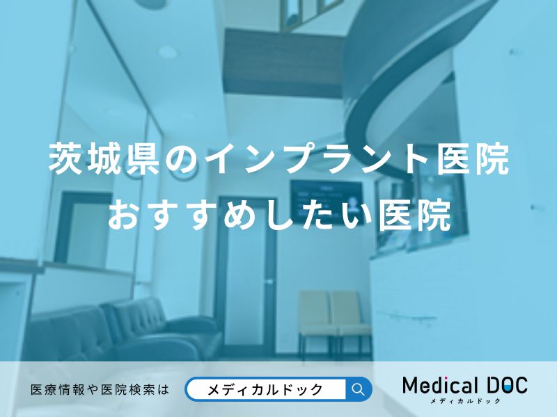 茨城県のインプラント医院 おすすめしたい医院
