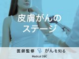 「皮膚がんのステージ」はご存知ですか？種類別に解説！医師が監修！