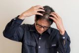 非公開: AGA治療（薄毛治療）の効果が出るのはいつから？治療方法やメリット・デメリット