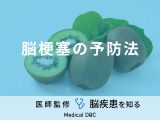 「脳梗塞を予防」する可能性の高い食べ物はご存知ですか？医師が徹底解説！