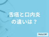「舌癌と口内炎の違い」は？放置してはいけない”期間と症状”を医師が解説！