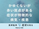 非公開: 「かゆくないが赤い斑点がある」症状が特徴的な病気・疾患はご存知ですか？