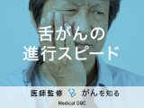 「舌がんの進行スピード」はご存知ですか？受診の目安や治療法も解説！医師が監修！