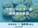 「アルツハイマー型認知症の原因」となる可能性の高い食べものはご存知ですか？