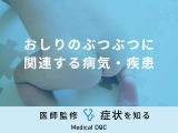 非公開: 「おしりのぶつぶつ」症状が特徴的な病気・疾患はご存知ですか？医師が解説！