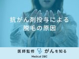 「抗がん剤投与による脱毛の原因」はご存知ですか？脱毛がない人の特徴も医師が解説！