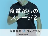 「食道がんステージ2」の症状・治療法はご存知ですか？【医師監修】
