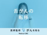 「舌がんが転移」しやすい部位や治療法はご存知ですか？【医師監修】