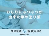 非公開: 「おしりのぶつぶつ」に効果な市販塗り薬はご存知ですか？医師が徹底解説！