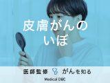 「皮膚がん」と「良性のいぼ」の見分け方はご存知ですか？【医師監修】