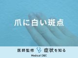 「爪に白い斑点」ができる原因はご存知ですか？医師が徹底解説！