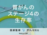 「胃がん・ステージ4の生存率」はご存知ですか？治療法も解説！【医師監修】