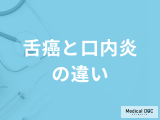 「舌癌と口内炎の違い」は舌のどこをチェックすれば良い？見分け方を医師が解説！